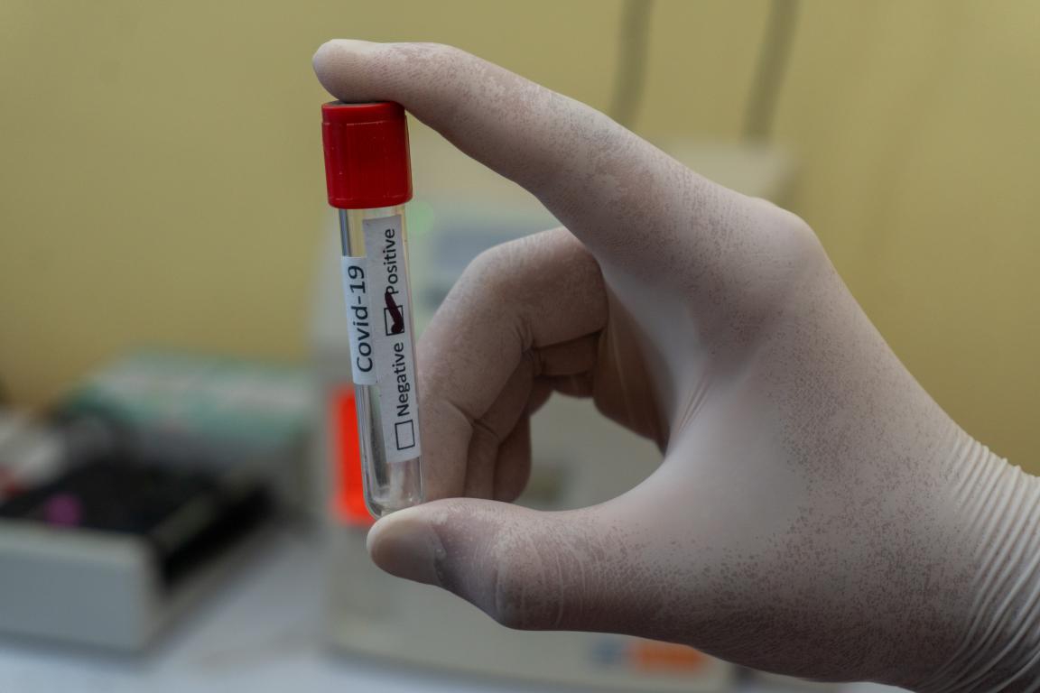 15 novopozitivnih osoba s područja OBŽ