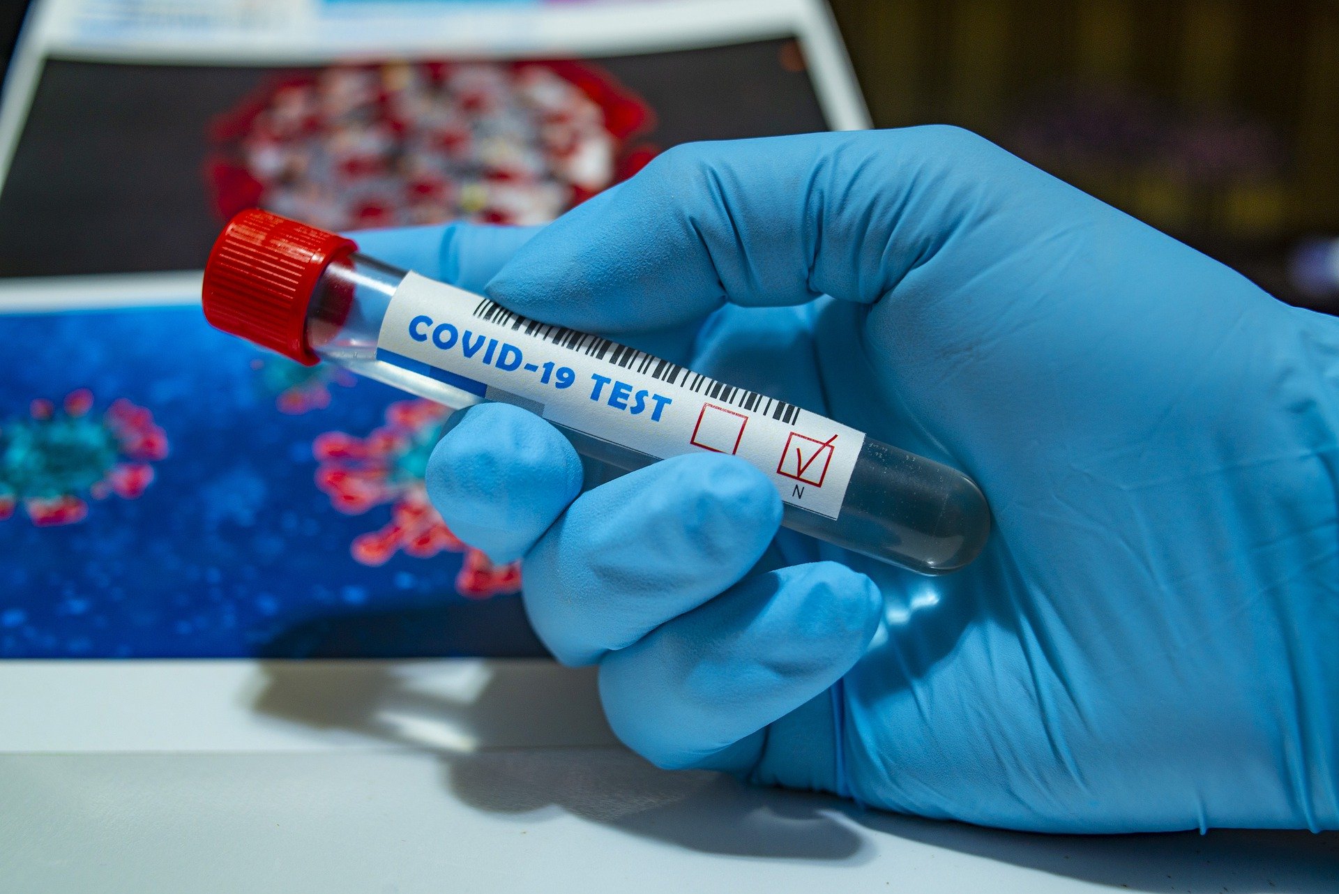 Smiruje se epidemiološka situacija u Osječko-baranjskoj županiji