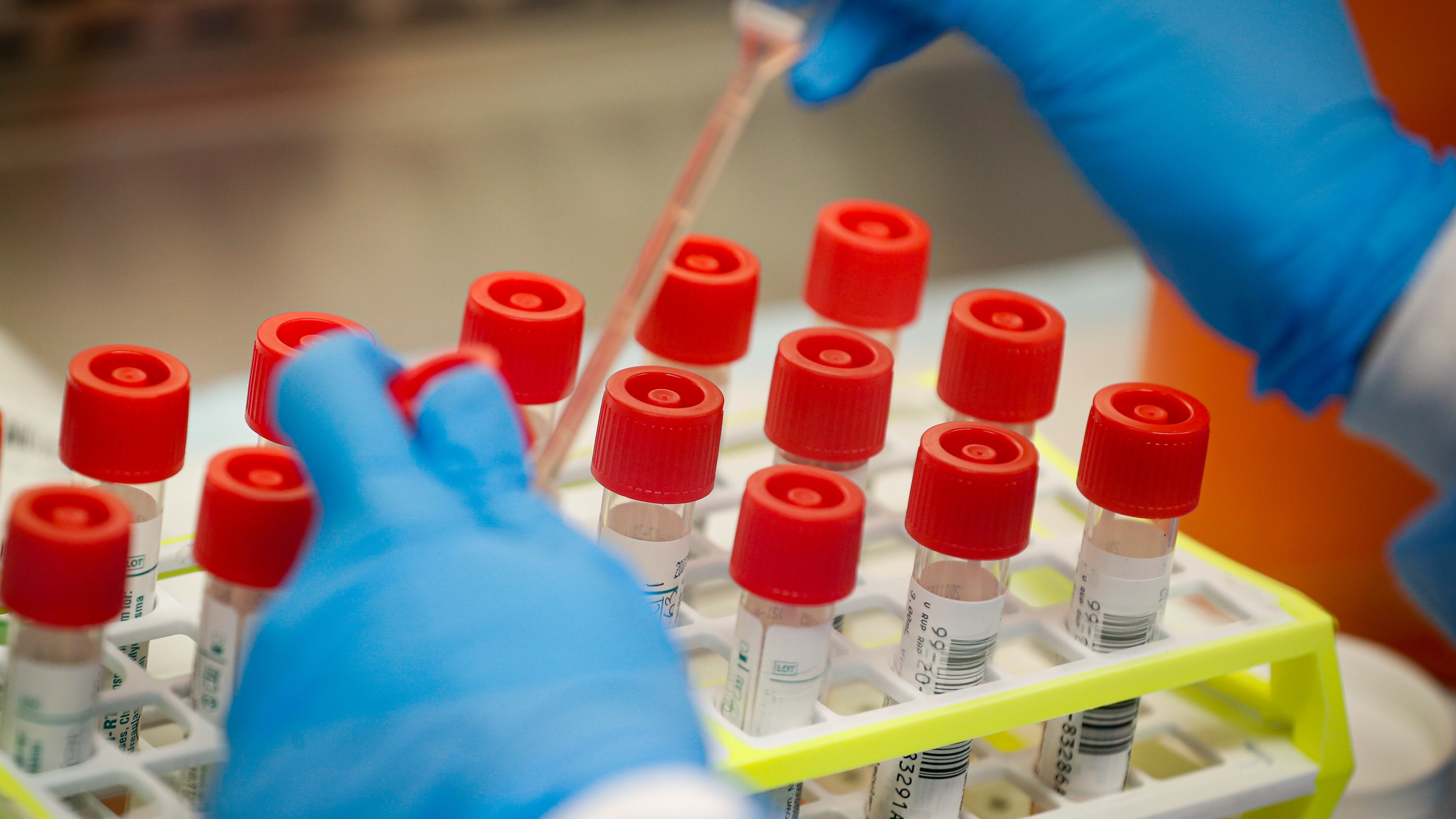 Na koronavirus novopozitivne 82 osobe, preminulo sedam osoba