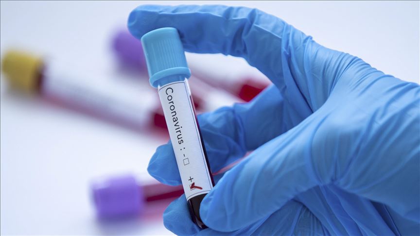 U OBŽ 181 osoba novopozitivna na koronavirus
