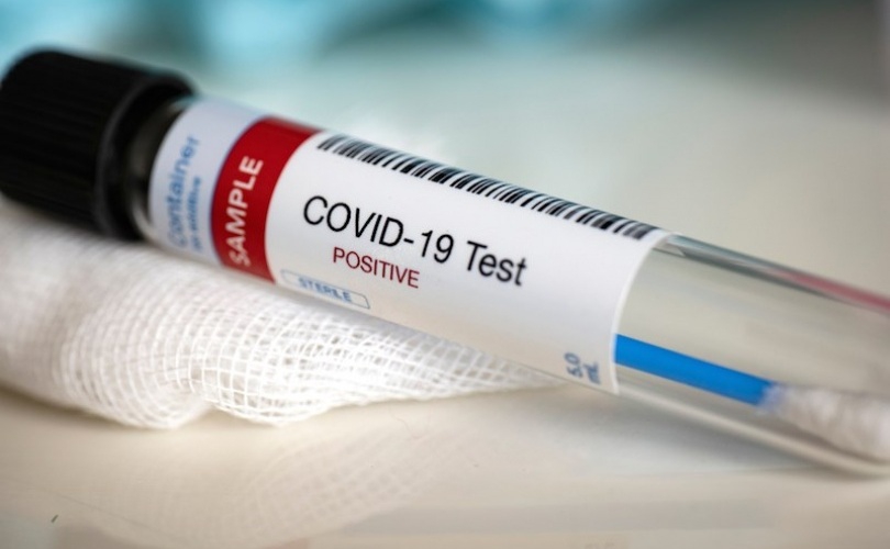 Osam novopozitivnih na koronavirus